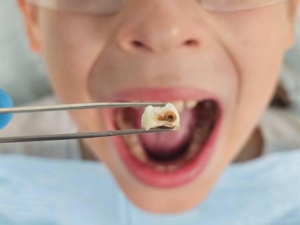 Best Emergency Dentist for Kids  in Portage, MI